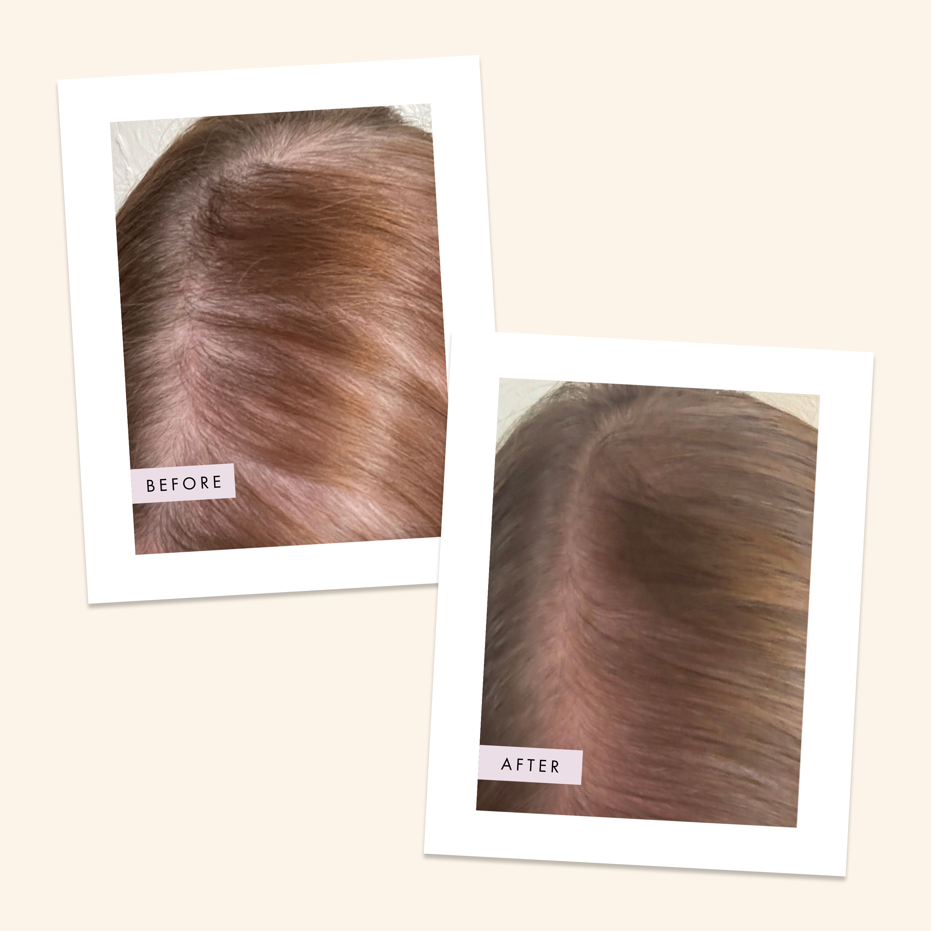 Hair Gain – wholesale Hair thinning/loss treatment – Hair Gain Scalp Foam7