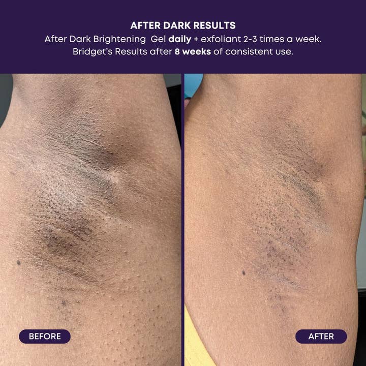 Bushbalm - Wholesale Facial Moisturizer - After Dark Brightening Gel 3