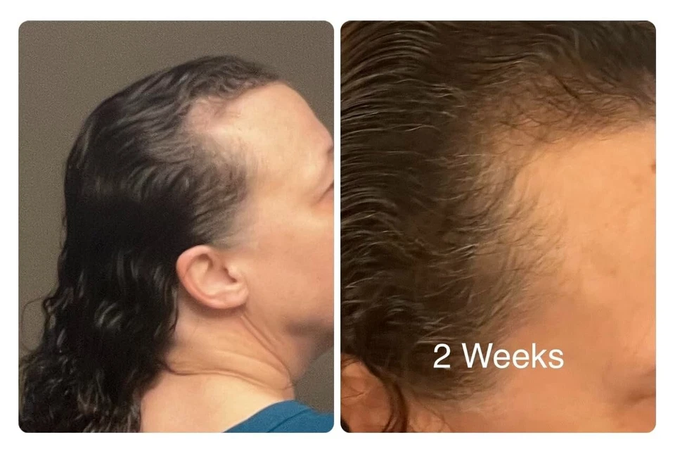 Au Natural Organics – wholesale Hair oil – Bulk Pure Batana Oil for Hair Growth Supplier Honduras 1 ltr7