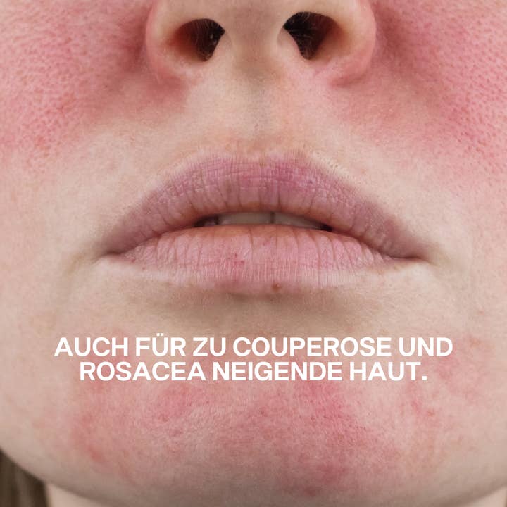 Marbert - Wholesale Facial Moisturizer - No More Red - Cream against redness - rich3