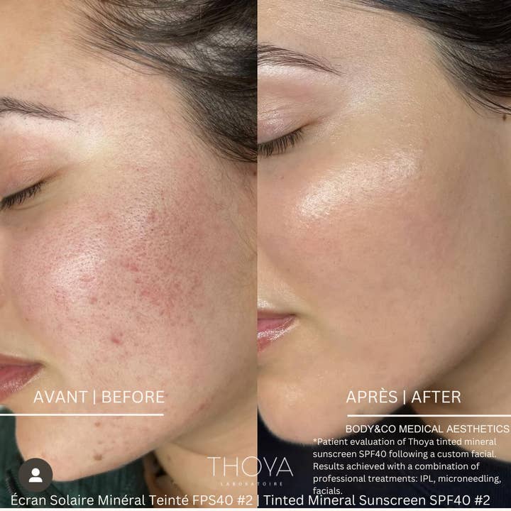Thoya Laboratoire - Wholesale Sunscreen - All Natural Tinted Mineral Sunscreen SPF 40 tint 2 Rose Ivor6