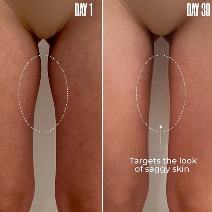 SlimSpa The Body Care Specialists - Wholesale Anti-Aging Moisturizer - ThighTight™ – Inner Thigh Firming Cream 8 oz.5