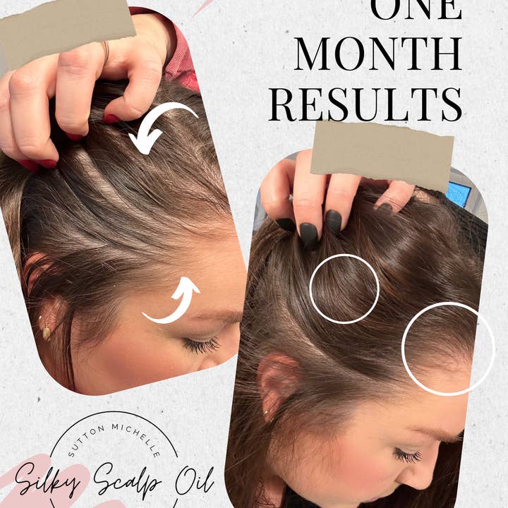 Sutton Michelle Designs - Wholesale Hair Oil - Growth Scalp Oil5