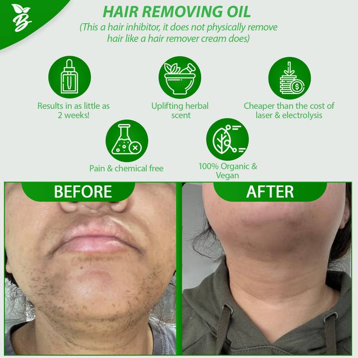 bconsciousnaturals – wholesale Body hair removal product – Hair Inhibitor/Remover Oil For Face & Body(Ingrown Hair)