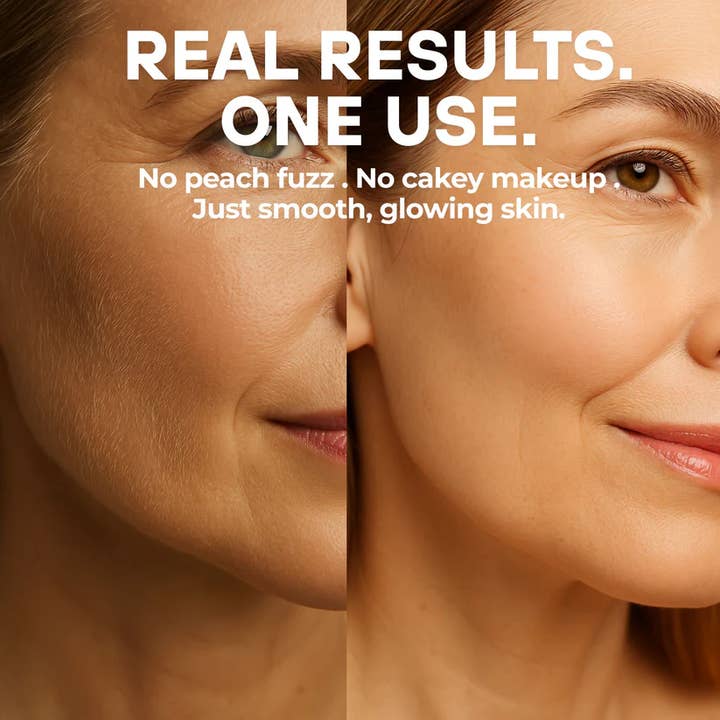 Image A.D.S – Großhandel Rasierklinge/Nachfüllung – Dermaplaning-Werkzeug, Flaum-Entferner | Salonqualität2