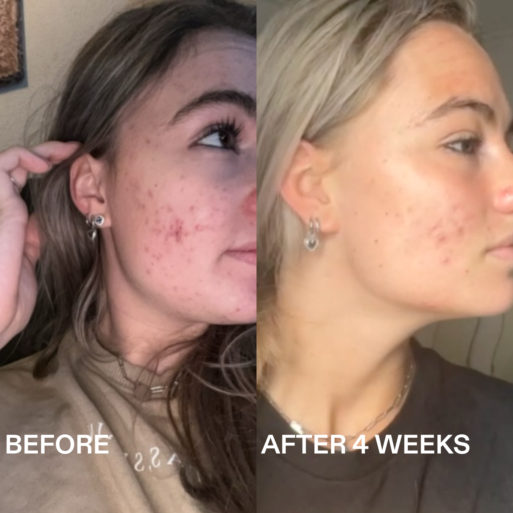 Routinely - Wholesale Facial Serum/Concentrate - 360° AZELAIC ACID SERUM1