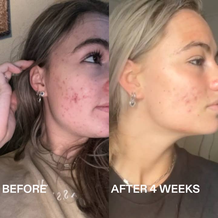 Routinely - Wholesale Facial Serum/Concentrate - 360° AZELAIC ACID SERUM1