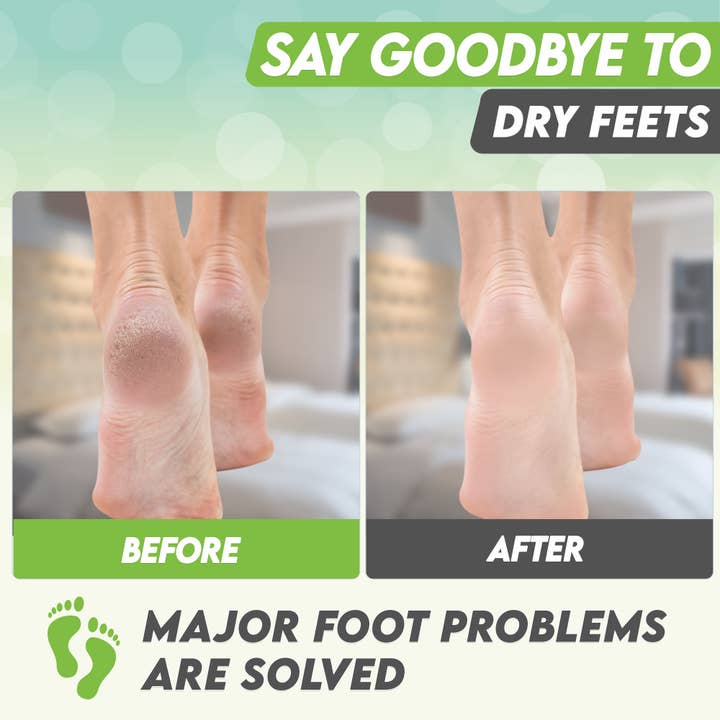 Karma Organic spa – wholesale Fotmask – Foot Peel Mask 2 Pack —Grönt te Fotmask skal 100% ekologisk4