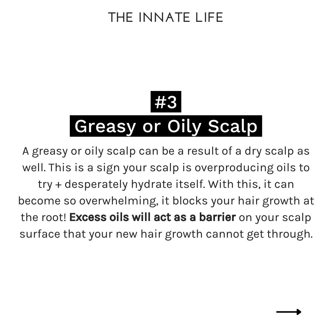 The Innate Life - Wholesale Scalp/Hair Treatment - CHARCOAL SCALP DETOX8