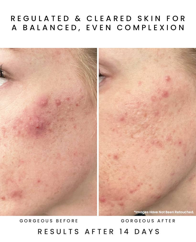 Earth Harbor Naturals - Wholesale Skincare Face Mask - GLOW JUICE 10-Acid Refining Peel: Fruit AHA/BHA 4