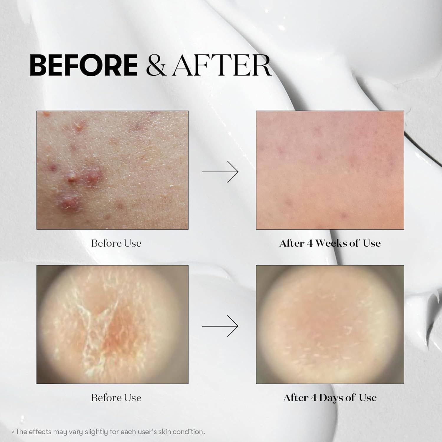 Sol Beauty Lab - Wholesale Facial Serum/Concentrate - VT COSMETICS CICA Reedle Shot 1002