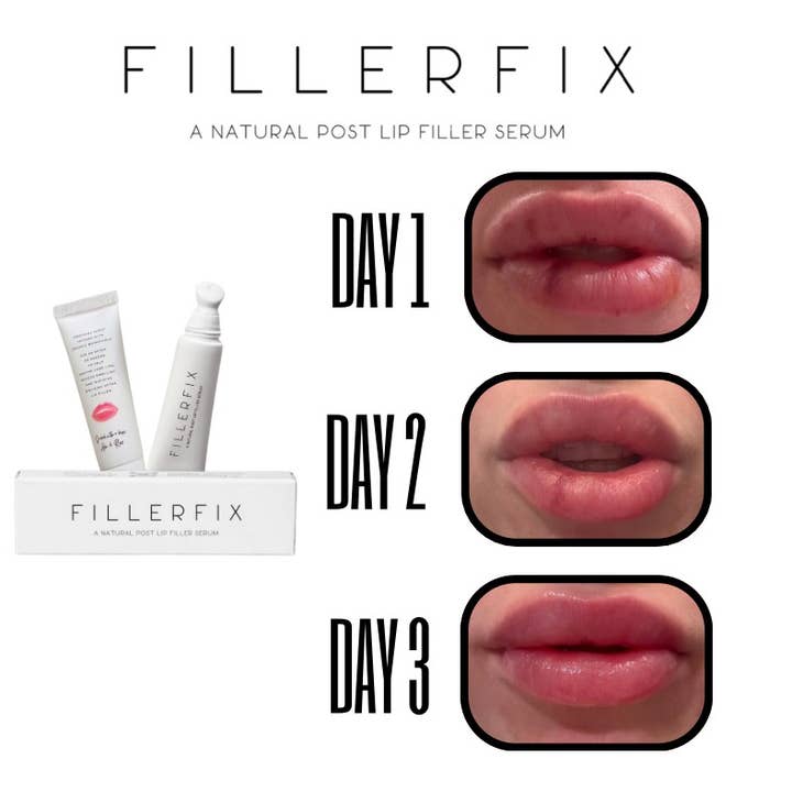 FillerFix Organic Lip Filler Aftercare Serum for wholesale by FillerFix