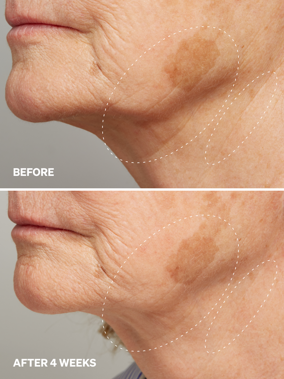 Onélogy – wholesale Facial serum/concentrate – Anti-Aging Serum – Peptides-Cu 0.64