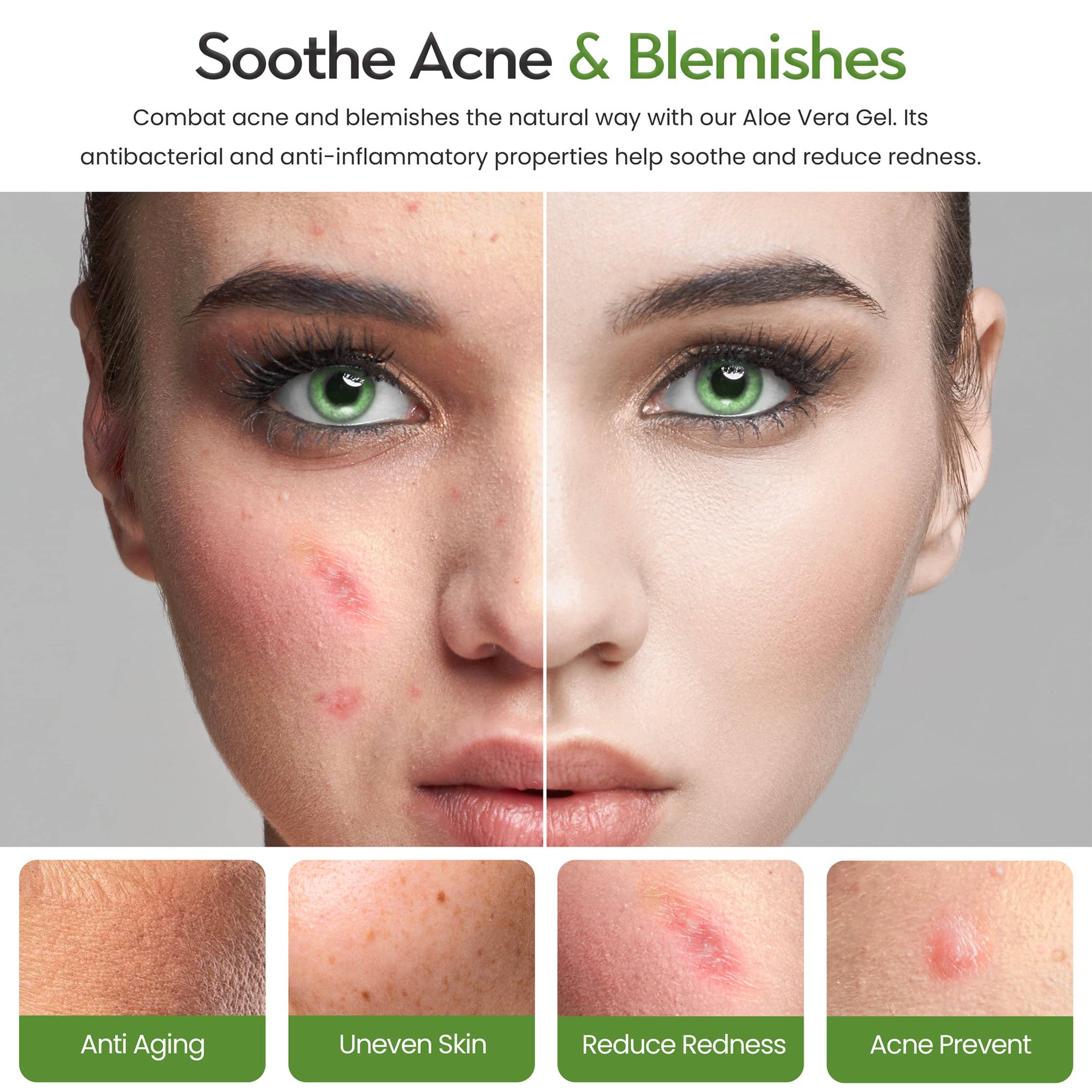 Freshskin Beauty LTD – wholesale After-sun/sun damage repair cream – Aloe Vera Gel - 250ml Tube3