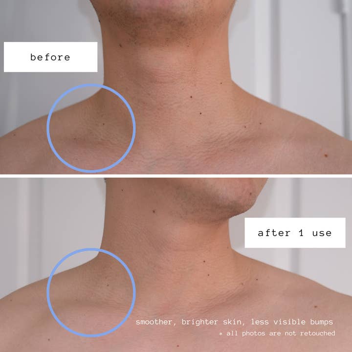 Sende Body-Care Essentials - Wholesale Exfoliating Gloves/Mitts - Body Exfoliating Kese Mitt | Normal to Rough Skin w/Elastic4