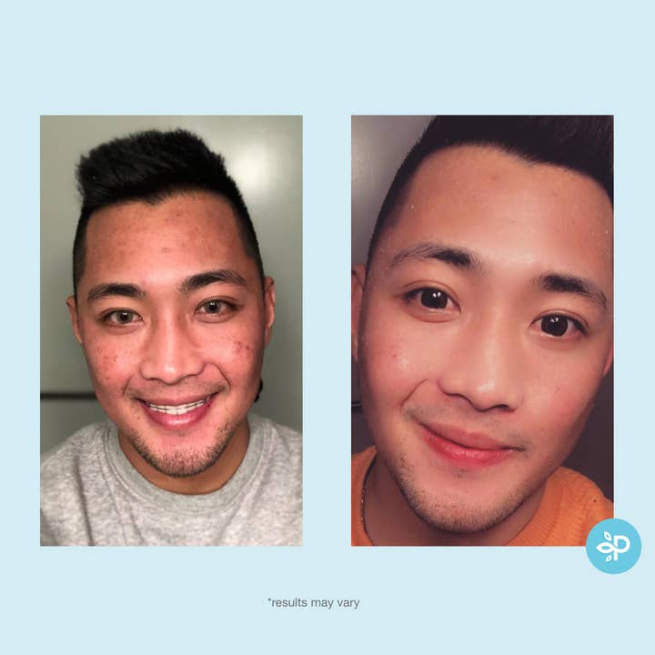 Perfect Image - Wholesale Facial Peel - Revitaboost Peel Pads - Level 26