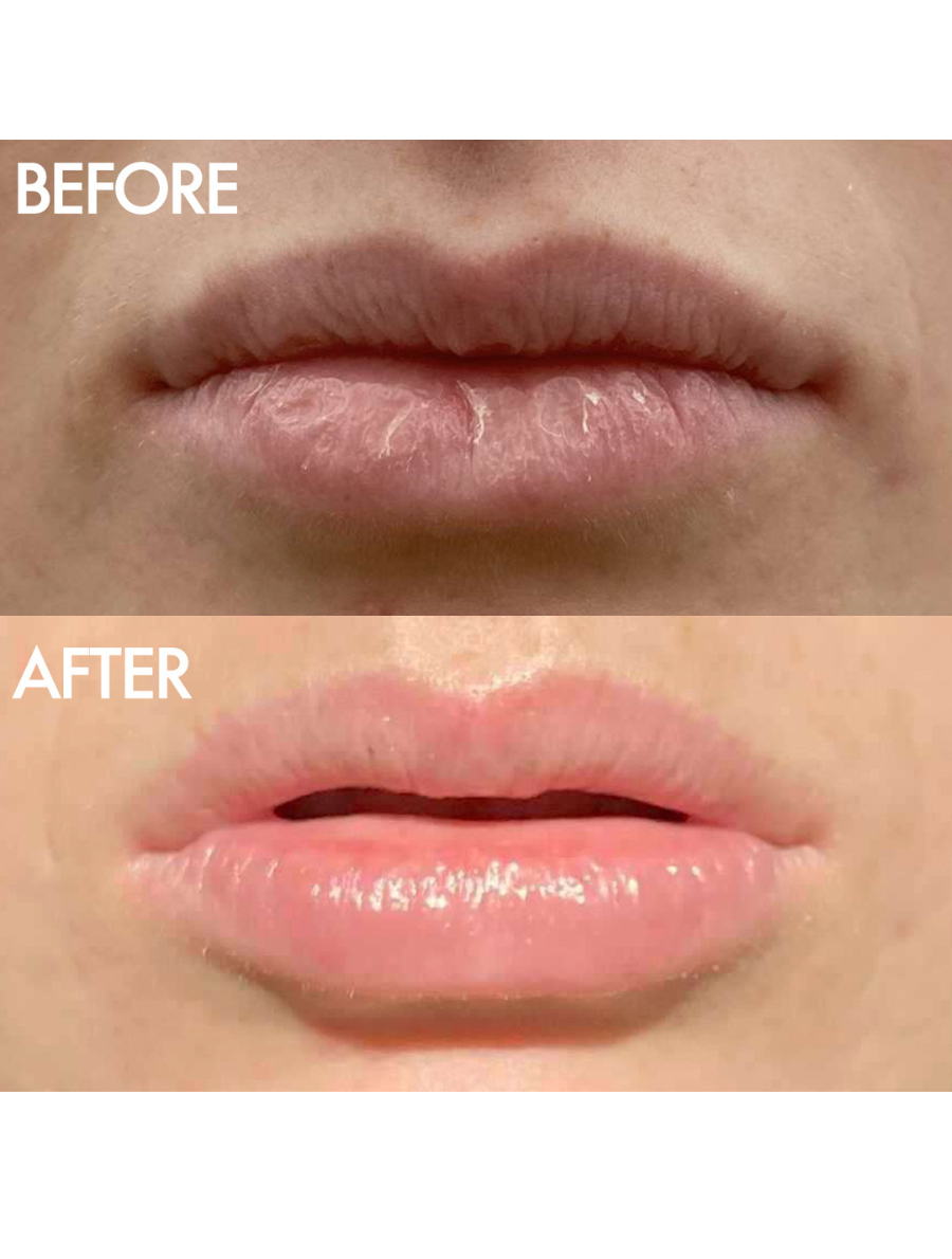 Lanolips - Wholesale Lip Balm - The Original 101 Ointment Multipurpose Superbalm5