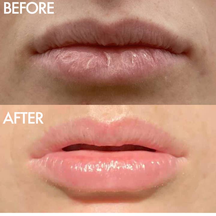 Lanolips - Wholesale Lip Balm - The Original 101 Ointment Multipurpose Superbalm5