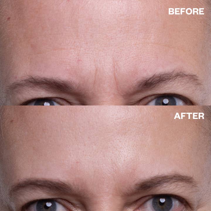 Wrinkles Schminkles - Wholesale Skincare Face Mask - Forehead Wrinkle Patches1