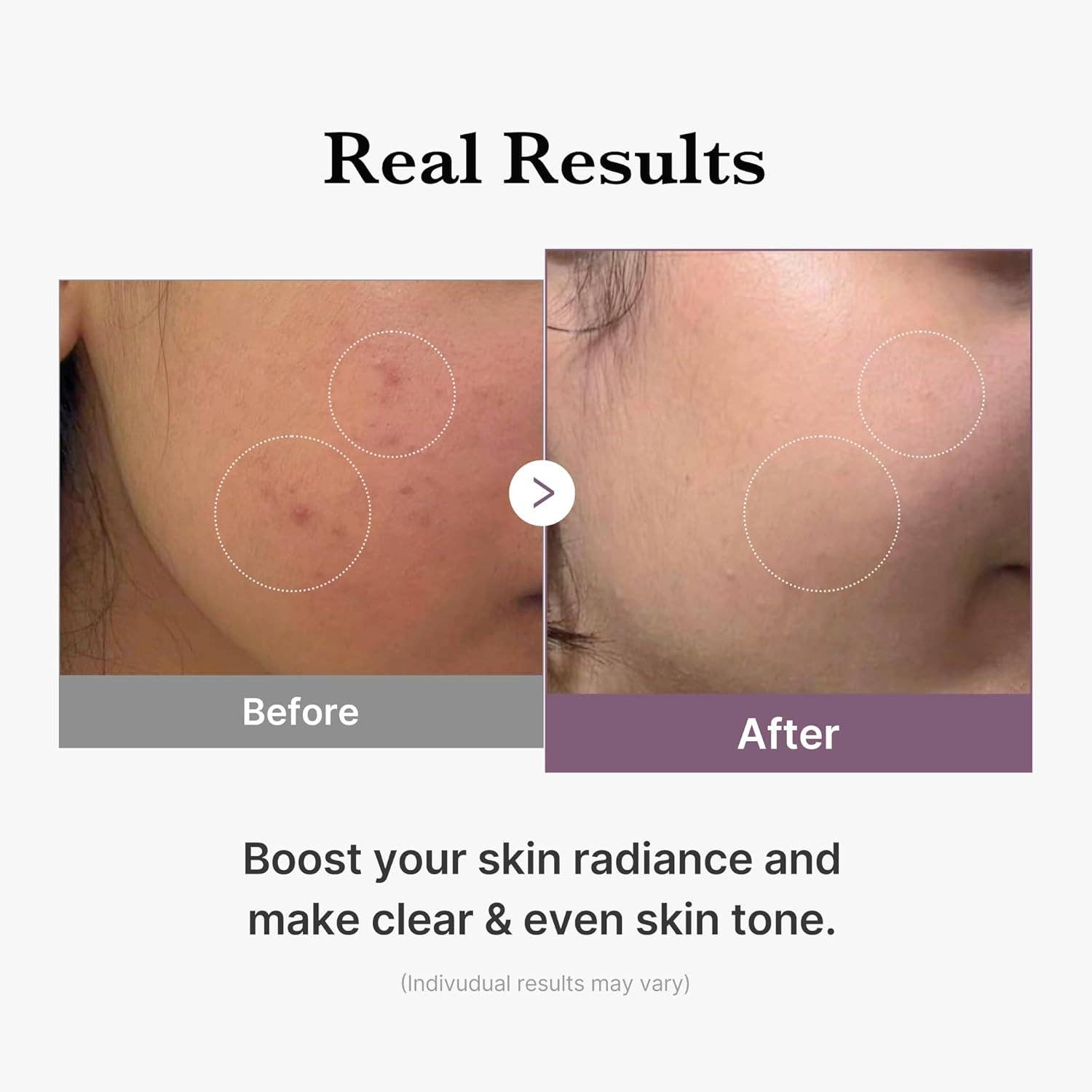 MEHIAZ – Toner facial por atacado – Medicube Age-R Glutathione Glow Leite Tónico, 150ml4