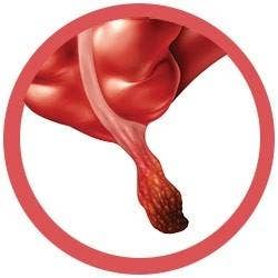 Heebie Jeebies - Wholesale Classic toy – Kids - Giant Microbe | Appendix2