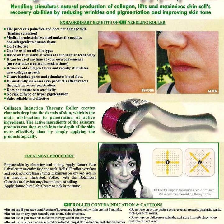 NATPURE Clinical Skin Care - Wholesale Face/Beauty Roller - CIT (Collagen Induction Therapy) Micro Needling Roller3