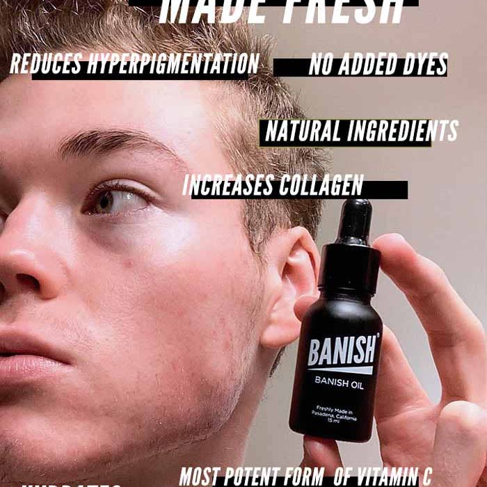 Banish - Wholesale Facial Serum/Concentrate - Banish Serum - Dark Spot Corrector Vitamin C Serum3