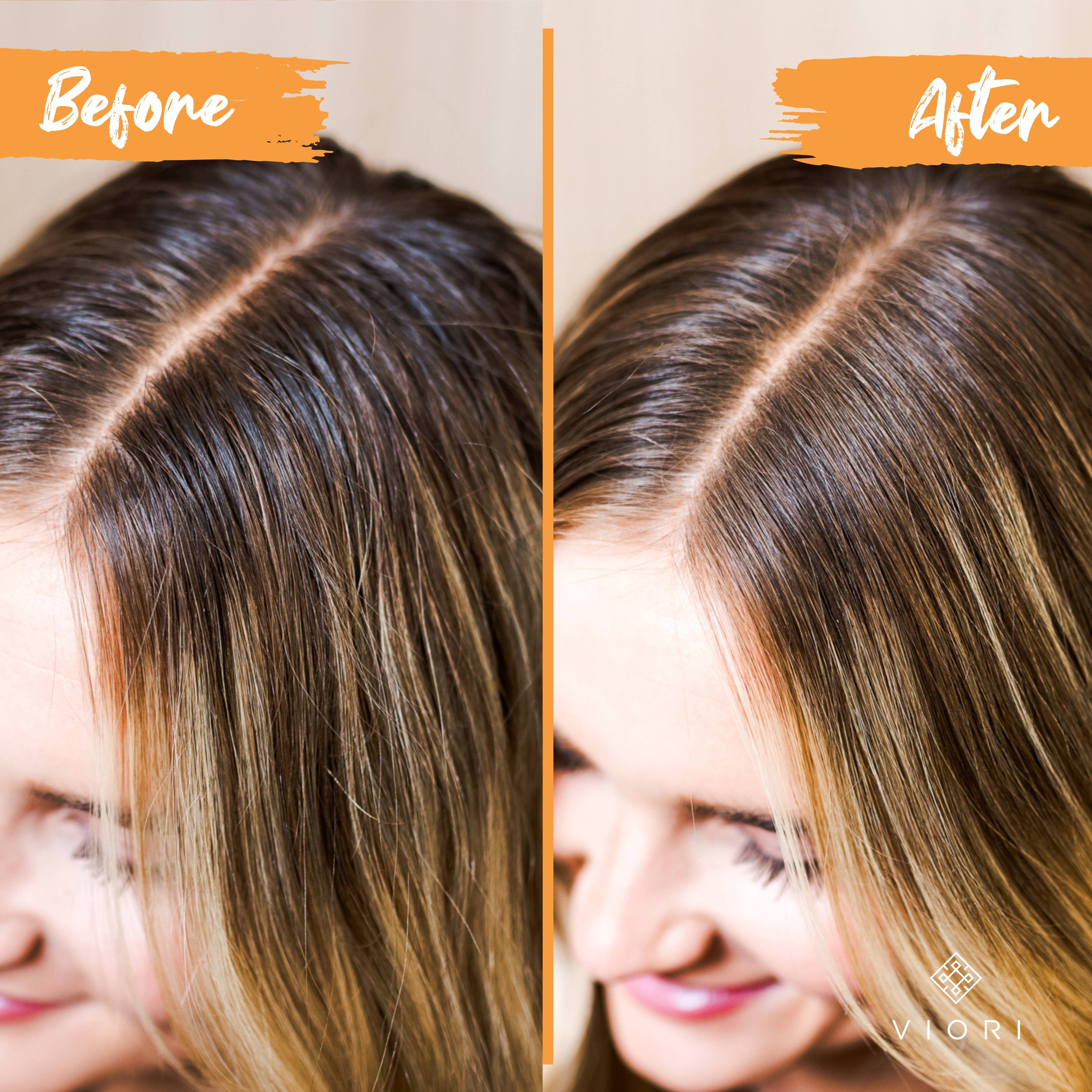 Viori Beauty – wholesale Shampoo puck/solid shampoo – Rice Water Shampoo Bar | Citrus Zest EO | Oily Hair6