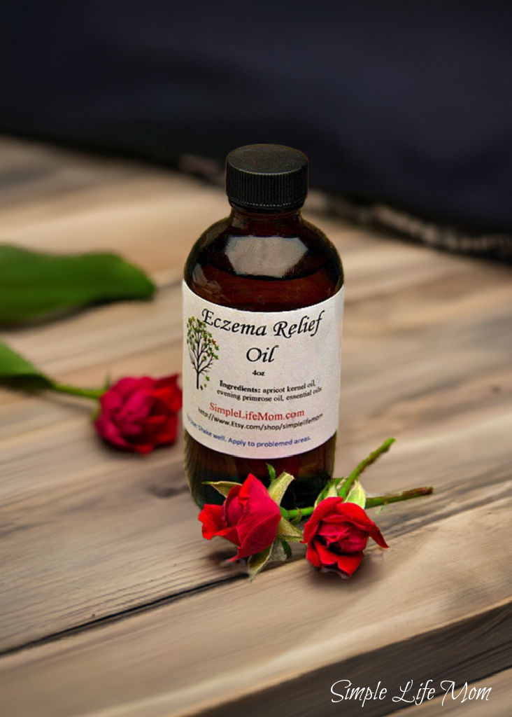 Simple Life Mom - Wholesale Bath/Body Oil - ECZEMA RELIEF OIL - 4oz soothe irritated, dry skin, organic body oil with essential oils, dermatitis oil5