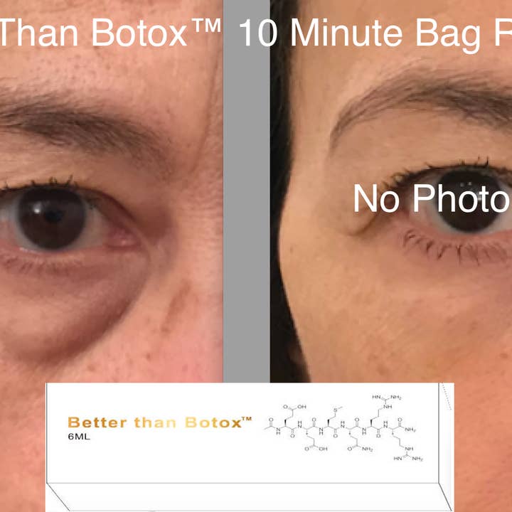 NABulous - Wholesale Facial serum/concentrate - Quantum Facial "Professional Edition"Better than Botox™ Under Eye Wrinkles8