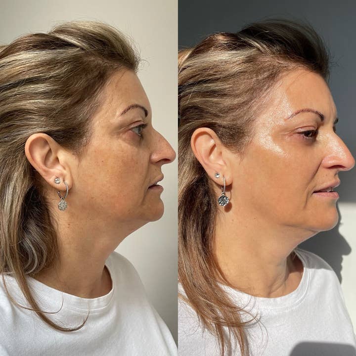 Kahlia Skin - Wholesale Skincare face mask - LED Silicone Radiant Mask - Face, Neck & Décolletage5