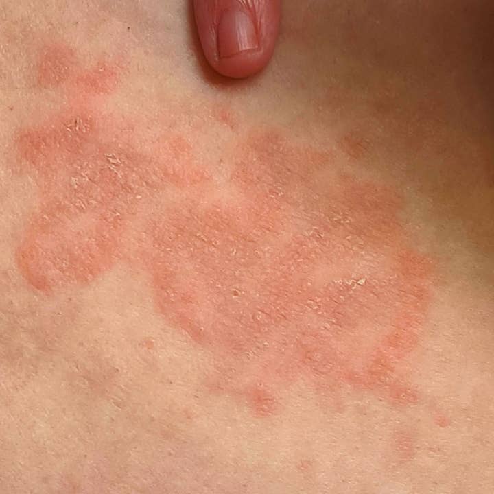 Nancy Natural Beauty Skincare - Vendita all'ingrosso Crema/lozione corpo - Sapone e crema naturali contro la tricofitosi3