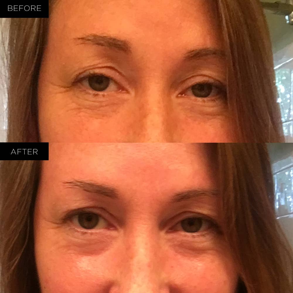 Endure Beauty – wholesale Eye treatment mask – Endure Under Eye Therapy Gel Pads - Renewing3