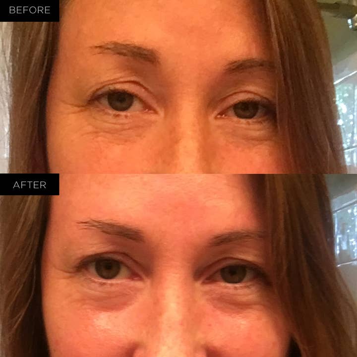 Endure Beauty - Wholesale Eye Treatment Mask - Endure Under Eye Therapy Gel Pads - Renewing3