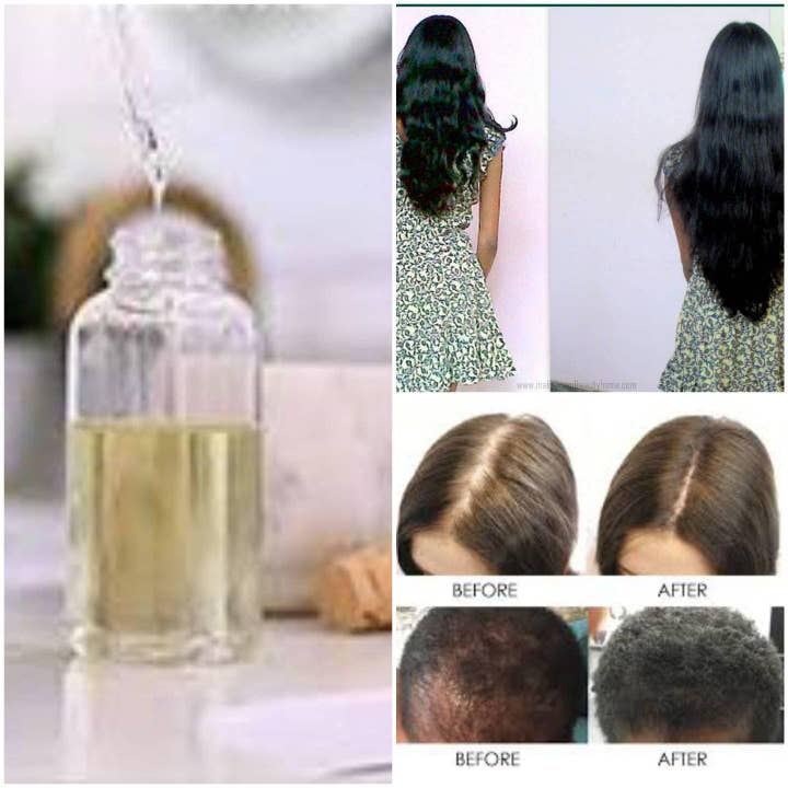 Hair Growth Oil Treatment for wholesale by Ladell Organics