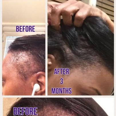 Nature's Lab - Natural Sisters – wholesale Hair oil – Mega Growth Hair Elixir with Organic Herbs & Oils