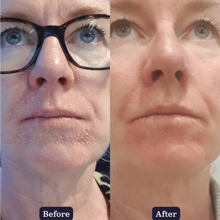 Edible Beauty Australia - Wholesale Facial moisturiser - & Coco Bliss Intensive Repair Creme3