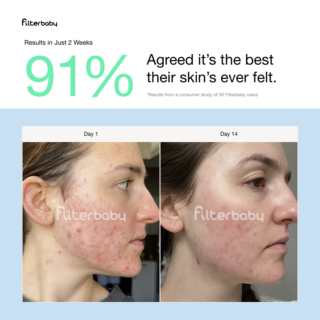 Filterbaby - Vendita all'ingrosso Rulli viso/di bellezza - Filtro per rubinetto Skincare Filterbaby 2.010