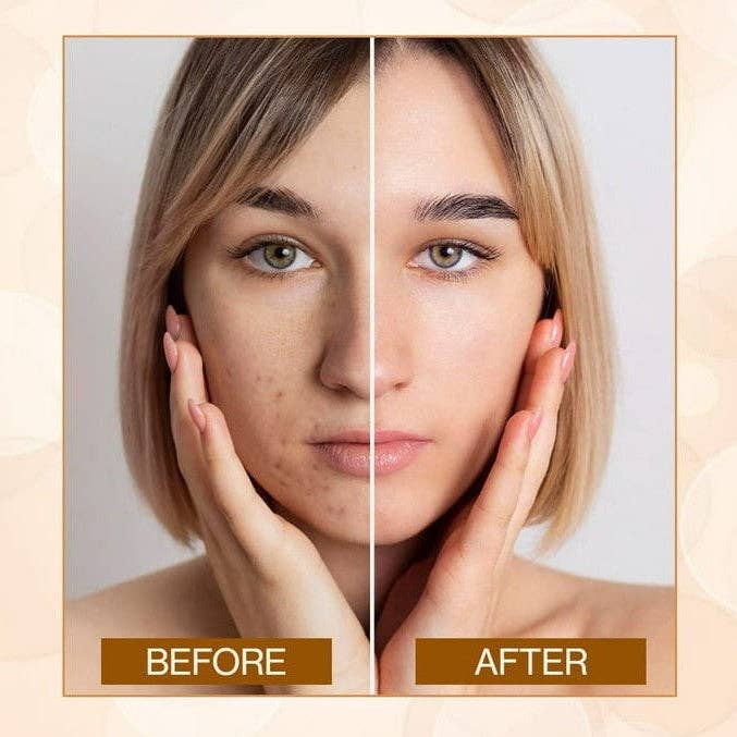 VIAI Beauty - Wholesale Face Concealer - REVOLUTION Conceal & Define Supersize Concealer