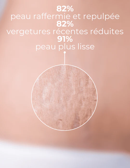 DERMEDEN - Wholesale Anti-Aging Moisturizer - Firming Stretch Mark Care2