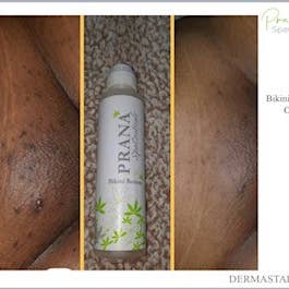 Dermastart Brands - Wholesale Body Scrub/Exfoliant - Bikini Bottom 3.4oz