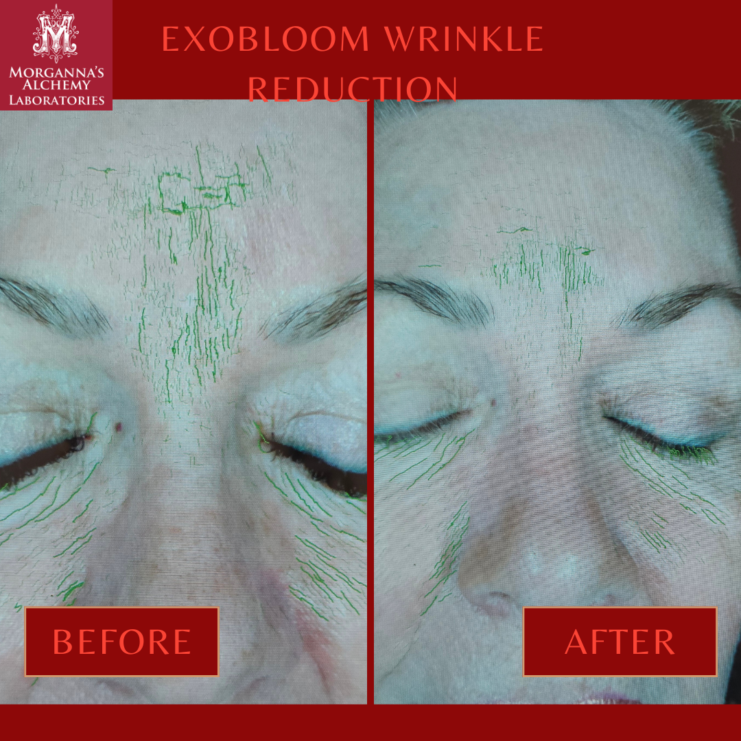 Morganna's Alchemy - Wholesale Anti-Aging Moisturizer - Morganna’s ExoBloom™ – Advanced Repair Gel with Plant Exosom4