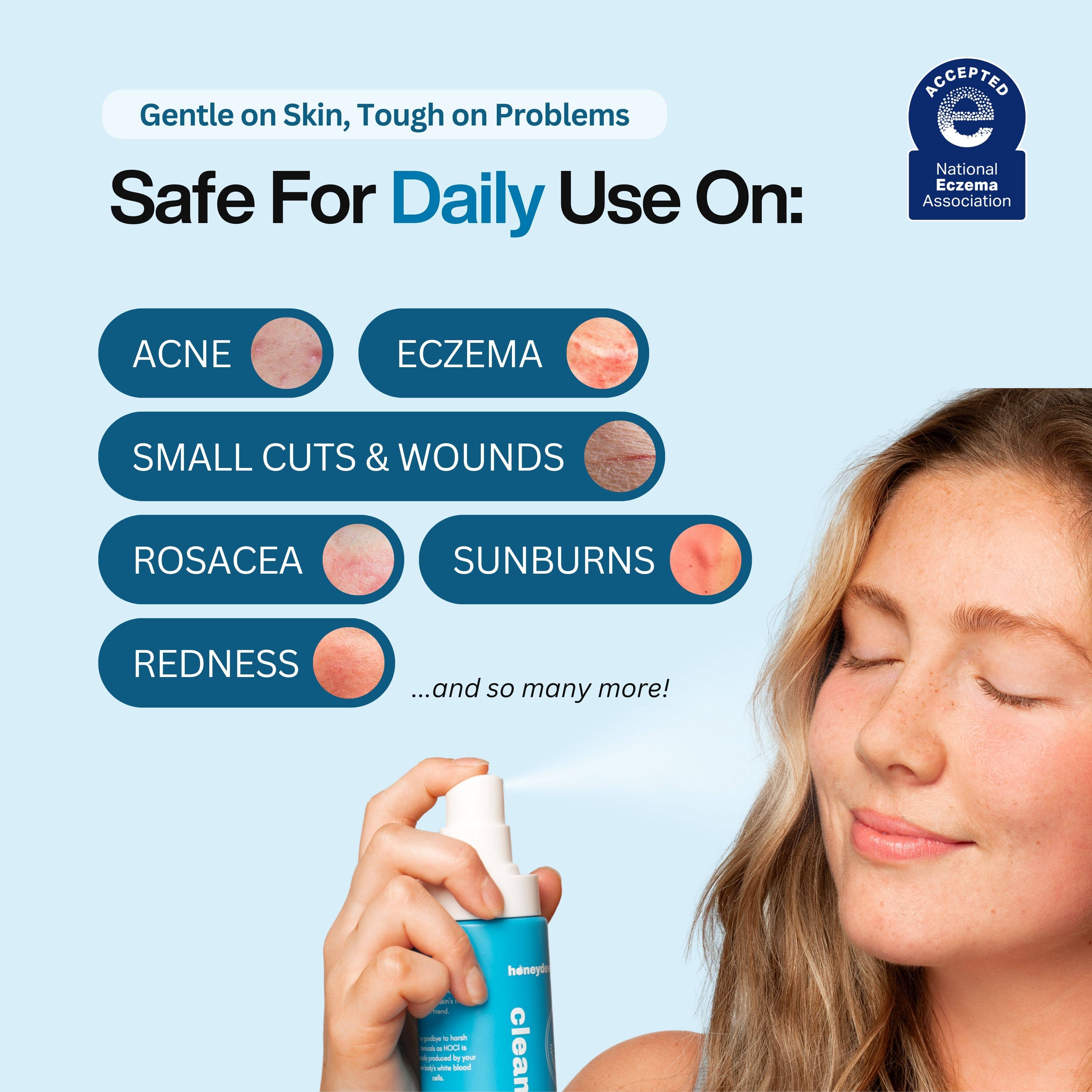 VC LEMONADE CORP. - Wholesale Face & Body Mist/Water - Hypochlorous Acid Spray for Face & Body5