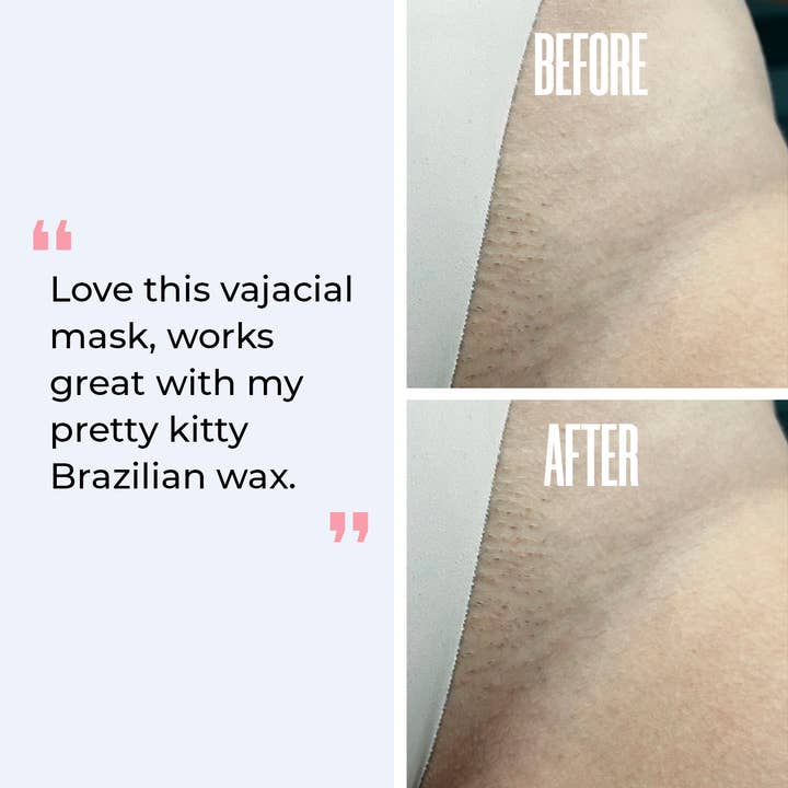 Divine Derriere - Wholesale Skincare face mask - Hydrogel Vajacial Kit - Hyaluronic Acid5