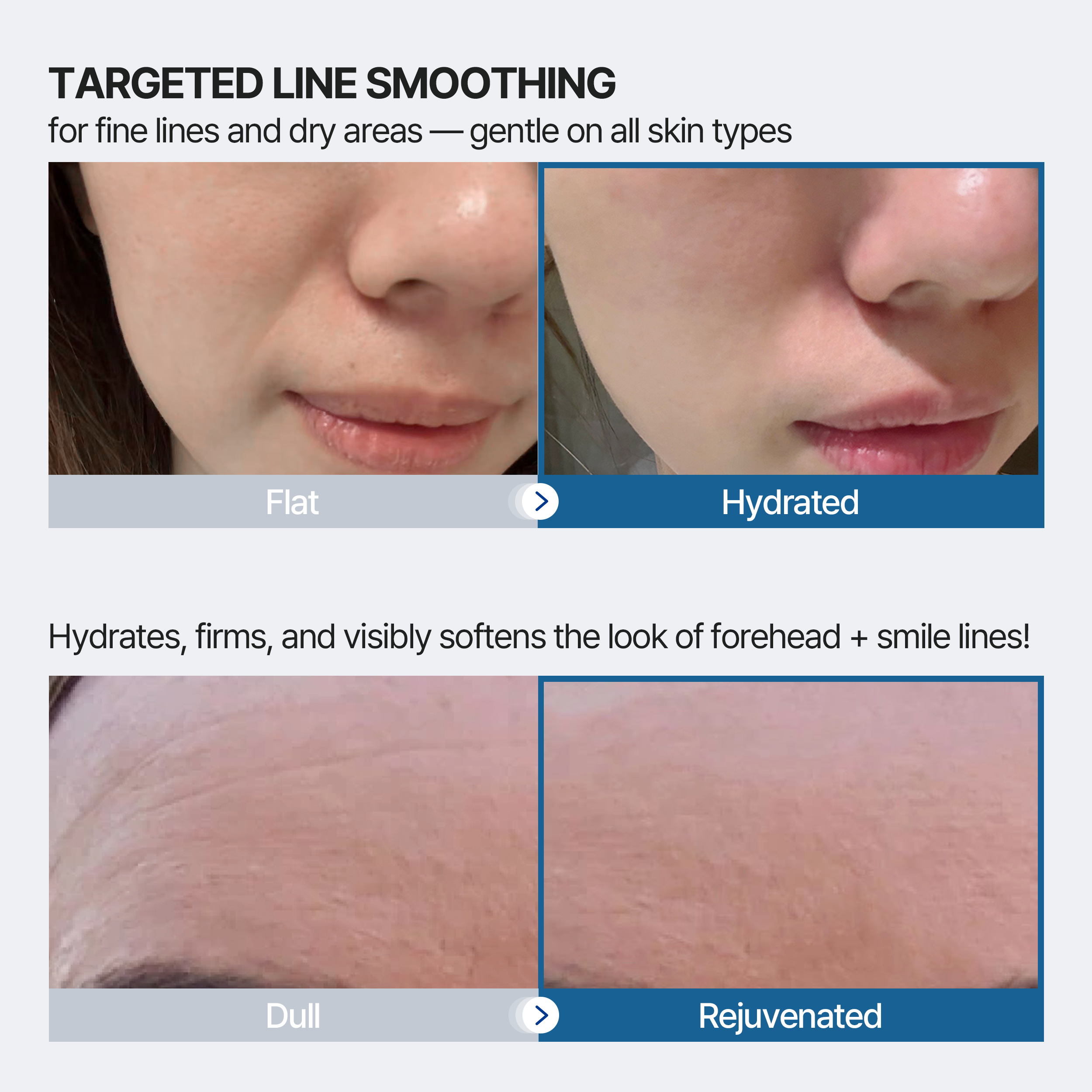 VC LEMONADE CORP. - Wholesale Skincare Face Mask - Forehead and Smile Line Wrinkle Patches3