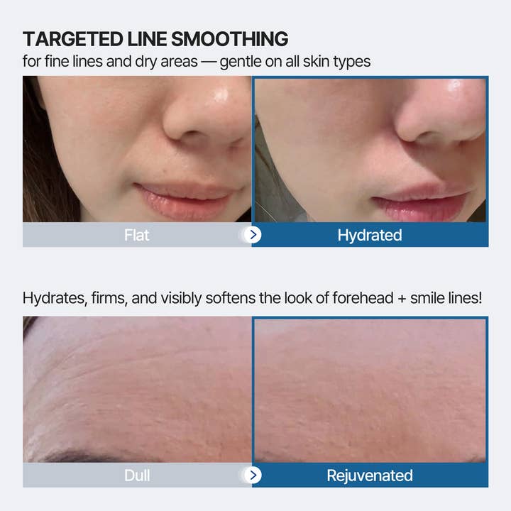 VC LEMONADE CORP. - Wholesale Skincare Face Mask - Forehead and Smile Line Wrinkle Patches3