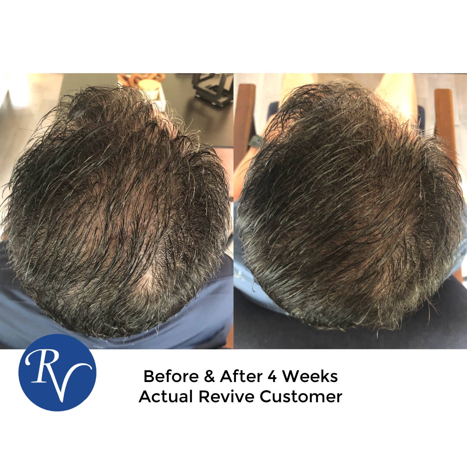 RemeVerse - Wholesale Hair Serum - Replenishing Hair Serum with Redensyl®6