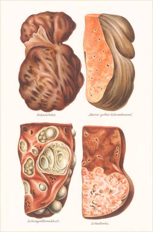 Found Image Press - Vente Cartes postales - Carte postale AY-216 Foies malades0