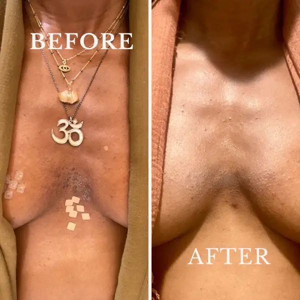 Violet Botanical Skincare - Wholesale Body Balm/Butter - Eczema Butter | For Very Dry, Eczema-Prone Skin4