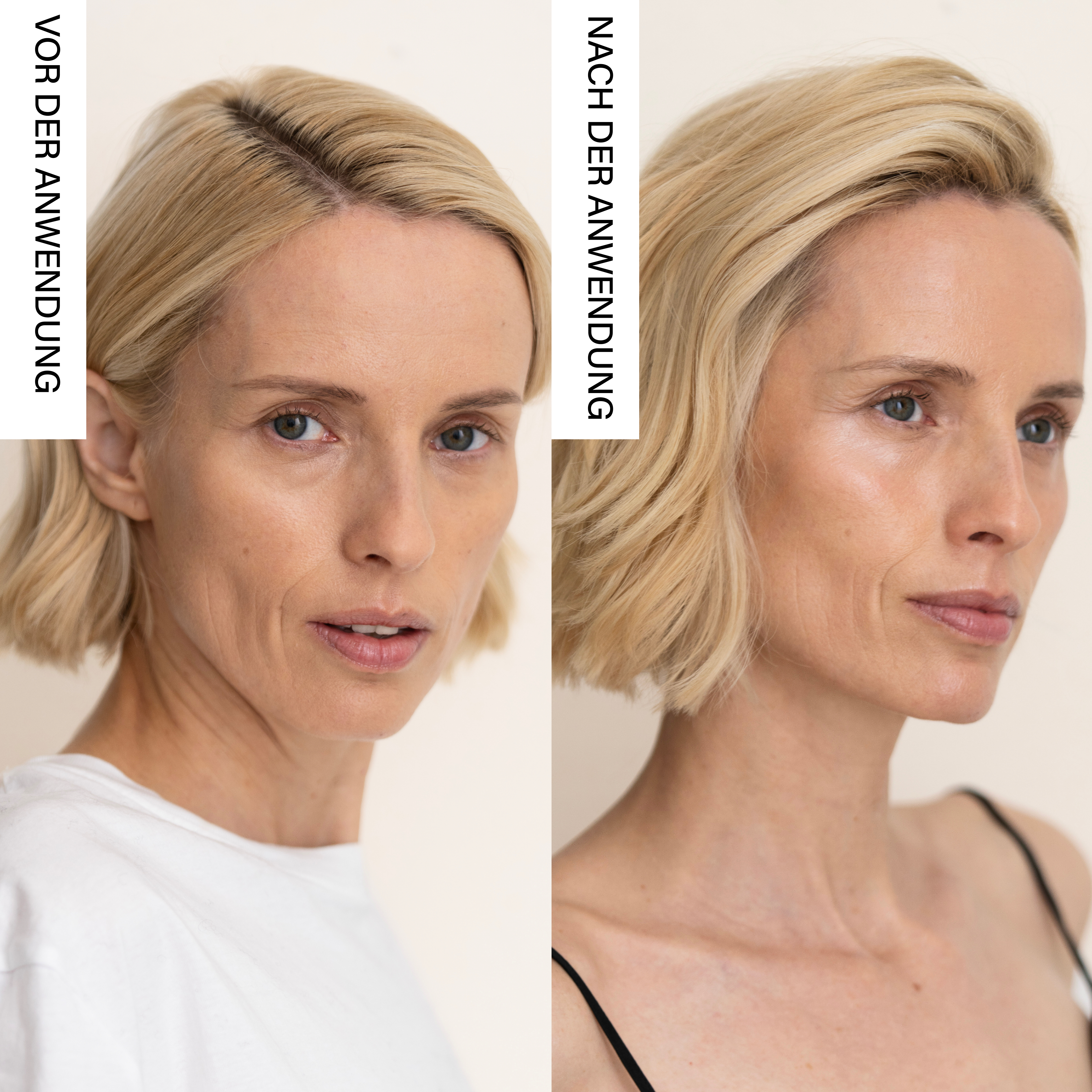 Rosental Organics - Wholesale Skincare Face Mask - LED Face Mask2